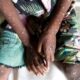 Monkeypox Mpox 80x80
